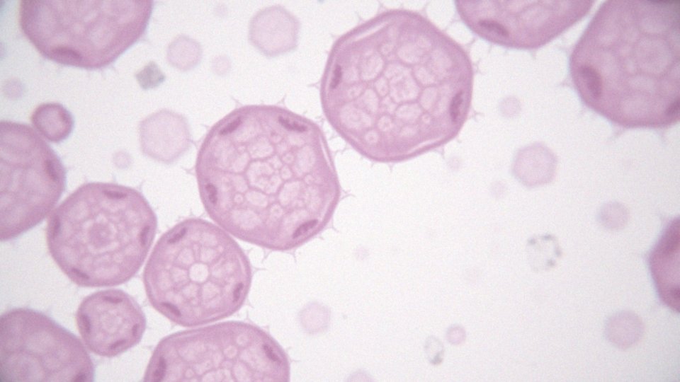 Cytologia metaplazja płaskonabłonkowa – przyczyny i znaczenie diagnostyki